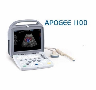 MÁY SIÊU ÂM 4D XÁCH TAY SIUI APOGEE 1100